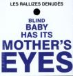 Blind Baby Has It's Mothers Eyes