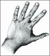 Eleven Fingers