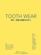 Tooth Wear ۑEC̐^߂