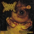 Teratoma