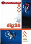 Dig 25 (Bmx)