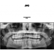 Jvc (Bonus Tracks)