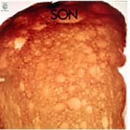 Son