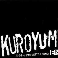 Emi 1994 -1998 Best Or Worst