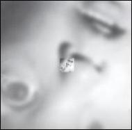 Bioentropic Damage Fractal