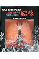 気道感染 気道の営みと結核感染 その1 結核