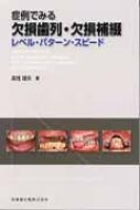 症例でみる欠損歯列・欠損補綴 レベル・パターン・スピード : 宮地建夫 