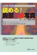 フェルソン読める!胸部X線写真 楽しく覚える基礎と実践 フェルソン 読める!胸部X線写真 改訂第3版/原著第4版 楽しく