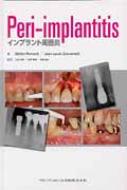 Peri-implantitis Cvg͉