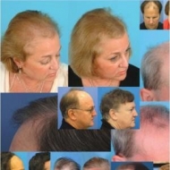 Bat-bike/Getting Back