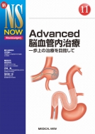Advanced]Ǔ ̎Âڎw VNS NOW
