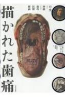 描かれた歯痛 白と黒、および神経からなる歯科医療挿画 wellcome