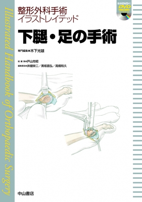 下腿・足の手術 DVD付 整形外科手術イラストレイテッド : 木下光雄 | HMV&BOOKS online - 9784521732572