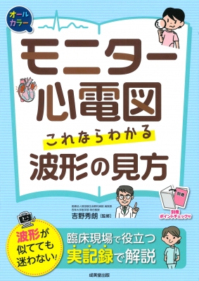 モニター心電図 これならわかる波形の見方 吉野秀朗 Hmv Books Online