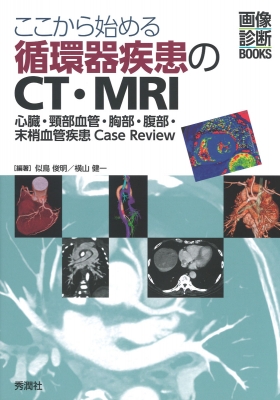 ここから始める循環器疾患のCT・MRI -心臓・頸部血管・胸部・腹部・末梢血管疾患Case Review- : 似鳥俊明 | HMV&BOOKS  online - 9784780909937