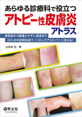 あらゆる診療科で役立つアトピー性皮膚炎アトラス : 出来尾格