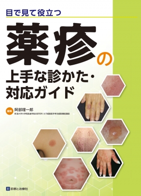 目で見て役立つ 薬疹の上手な診かた・対応ガイド : 阿部理一郎