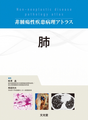 肺 非腫瘍性疾患病理アトラス : 蛇澤晶 | HMV&BOOKS online