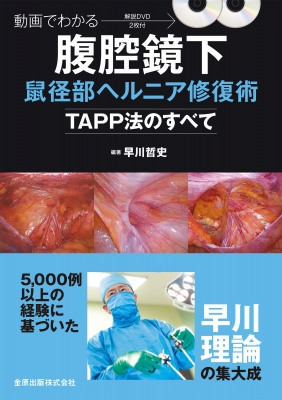 動画でわかる腹腔鏡下鼠径部ヘルニア修復術-TAPP法のすべて