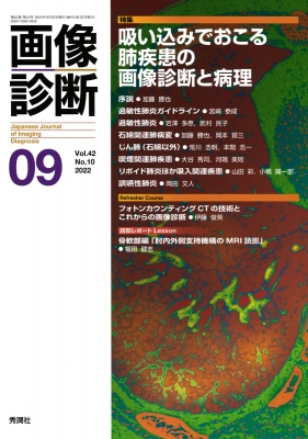 画像診断 2022年 9月号 Vol.42 No.10 : 画像診断実行編集委員会 | HMV&BOOKS online ...