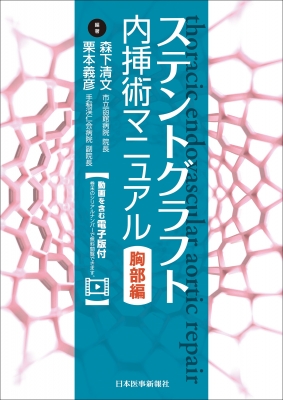 ステントグラフト内挿術マニュアル胸部編 : 森下清文 | HMV&BOOKS