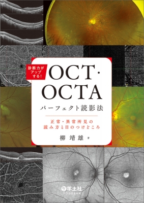 診断力がアップする!OCT OCTAパーフェクト読影法 （OCT眼底診断