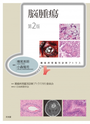 新編口腔外科・病理診断アトラス :20220522005147-00159:中古家電