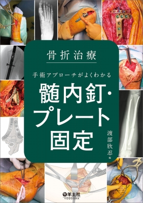 専用】股関節周囲の骨折・外傷の手術、髄内釘治療/プレート治療