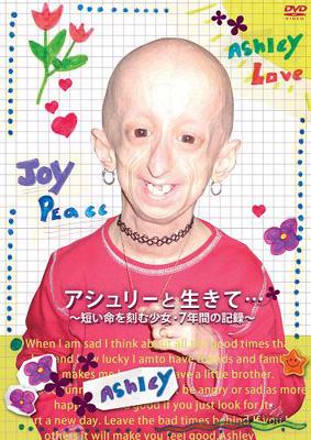 アシュリーと生きて 短い命を刻む少女 7年間の記録 Hmv Books Online Pcbc