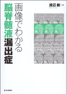 楽天ブックス: 画像でわかる脳脊髄液漏出症 - 渡辺新