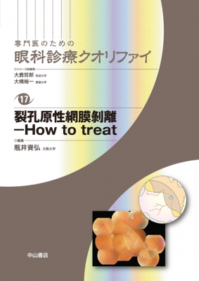 裂孔原性網膜剥離 How to treat 専門医のための眼科診療クオリファイ