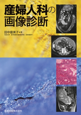 産婦人科の画像診断 : 田中優美子 | HMV&BOOKS online : Online