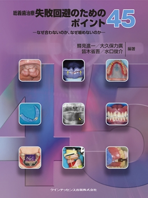 総義歯治療失敗回避のためのポイント45 なぜ合わないのか、なぜ噛め