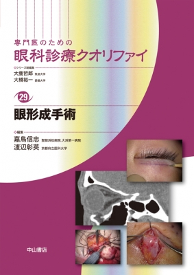 専門医のための眼科診療クオリファイ 29 眼形成手術 眼形成手術 29 専門医のための眼科診療クオリファイ : 嘉鳥信忠