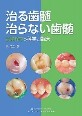 治る歯髄治らない歯髄 歯髄保存の科学と臨床 : 泉英之 | HMV&BOOKS 