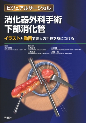 ビジュアルサージカル　消化器腹腔鏡下手術下部消化管(裁断済み) ビジュアルサージカル『消化器腹腔鏡下手術 上部消化管