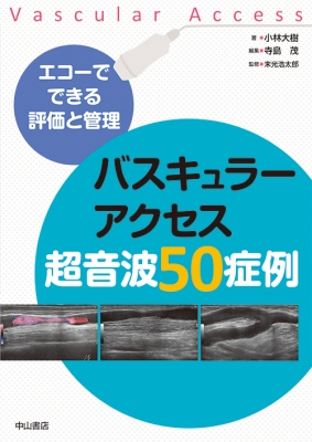 エコーでできる評価と管理 バスキュラーアクセス超音波50症例 : 小林 