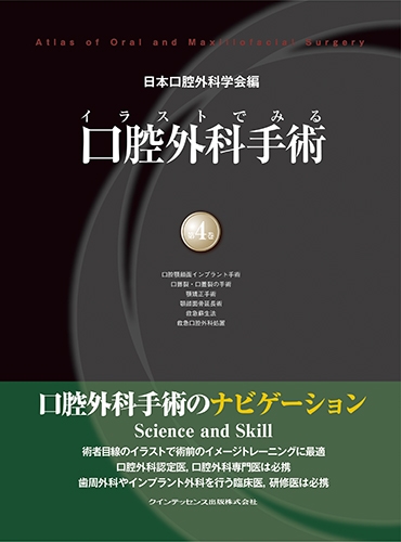 イラストでみる口腔外科手術 第4巻 : 日本口腔外科学会