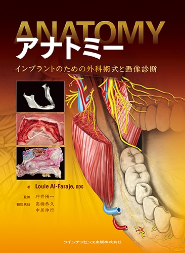 アナトミー インプラントのための外科術式と画像診断 : Louieal-faraje