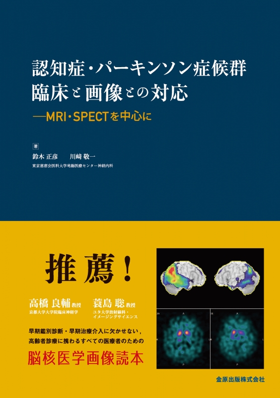 認知症・パーキンソン症候群画像と臨床との対応MRI・SPECTを中心に : 鈴木正彦 | HMVu0026BOOKS online -  9784307101820