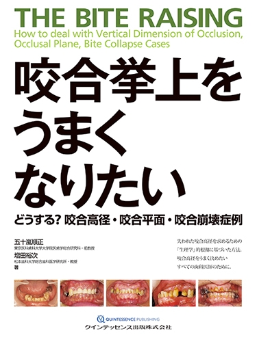 ⚠裁断済　咬合挙上をうまくなりたい どうする? 咬合高径・咬合平面・咬合崩壊症例 ⚠裁断済 咬合挙上をうまくなりたい どうする? 咬合高径・咬合