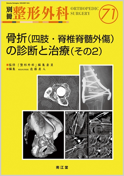 別冊整形外科 71 遠藤直人 Hmv Books Online 別冊整形外科 71 遠藤直人 Hmv Books Online