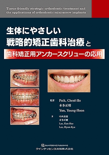 生体にやさしい戦略的矯正歯科治療と歯科矯正用アンカー