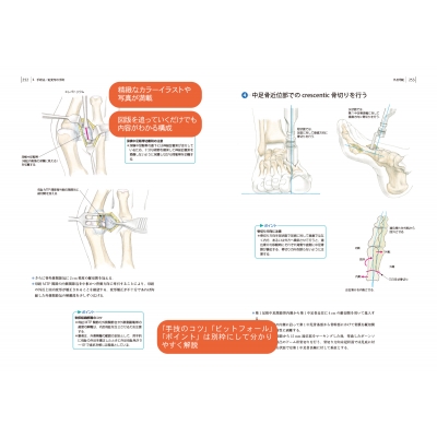 新作揃え 整形外科手術イラストレイテッド 下腿・足の手術 その他