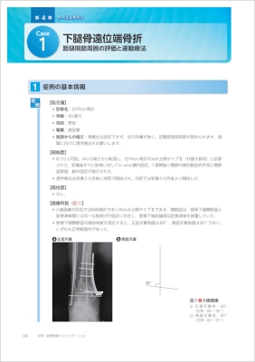 足部・足関節痛のリハビリテーション 痛みの理学療法シリーズ : 赤羽根 