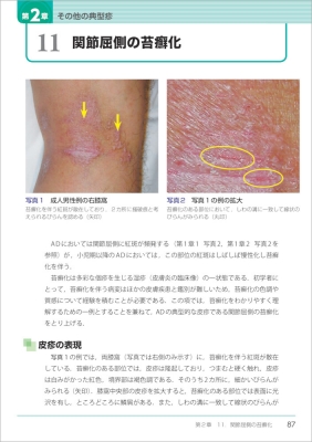 あらゆる診療科で役立つアトピー性皮膚炎アトラス : 出来尾格 あらゆる診療科で役立つアトピー性皮膚炎アトラス : 出来尾格