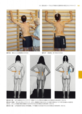 シュロス法による側弯症治療 エクササイズと呼吸テクニックで