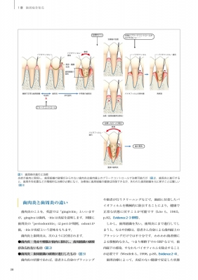 スカンジナビアンアプローチの実践 Dr.弘岡に訊く臨床的ペリオ講座