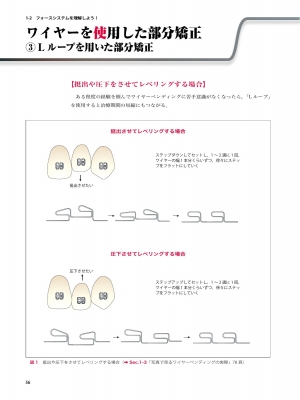 イラストと症例で学ぶ開業医のための臨床部分矯正 咬合育成から補綴前