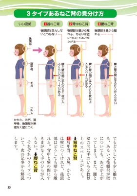 ねこ背 何歳からでも自力で治せる!整形外科の名医が教える最新1分体操大全 : 高平尚伸 | HMV&BOOKS online -  9784866514581